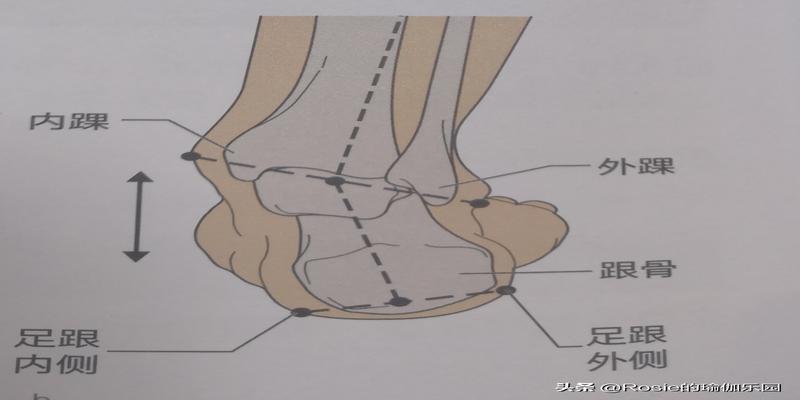 脚踝骨外翻(骨盆后倾大腿外翻)