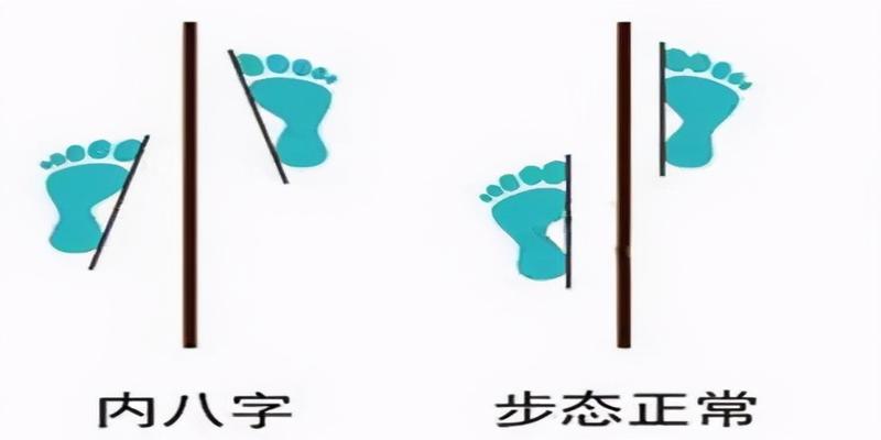 宝宝学走路八字步正常吗(宝宝学走路为什么是八字步)