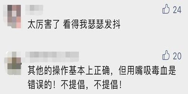 耗子算卦搁下爪子就忘(浙江男子被“超级毒蛇”咬了一口)